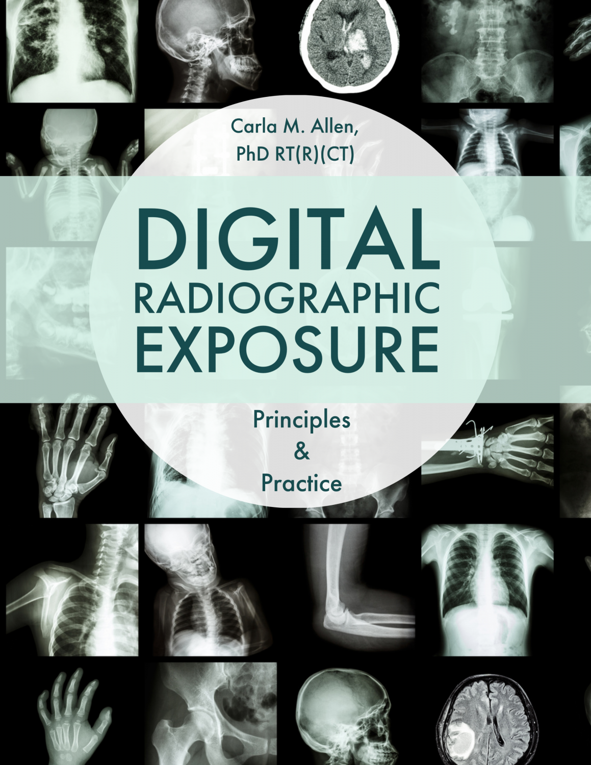 Cover image for Digital Radiographic Exposure: Principles & Practice