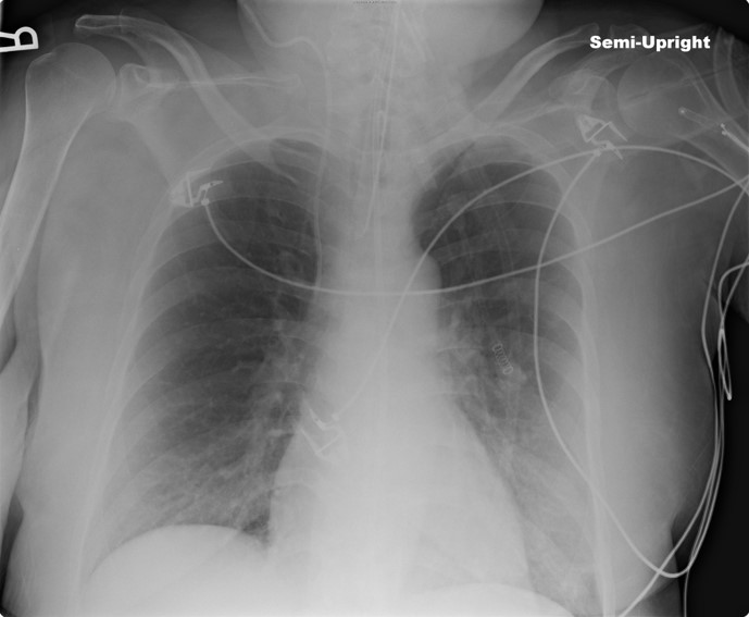 Guidelines for Image Evaluation – Digital Radiographic Exposure ...