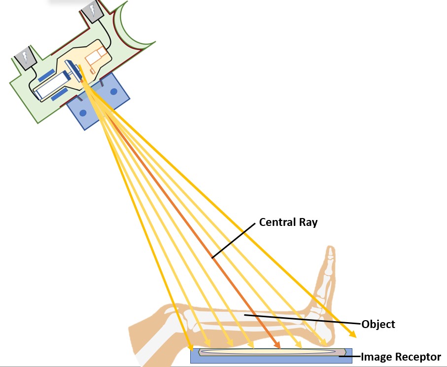 Radiographic Angulations – Digital Radiographic Exposure: Principles ...