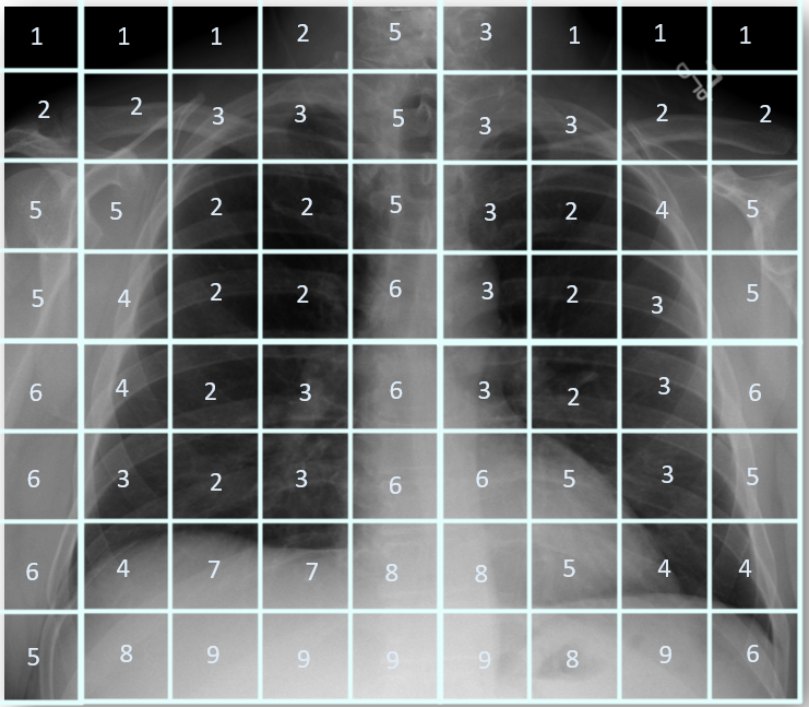 Image Capture and Display – Digital Radiographic Exposure: Principles ...