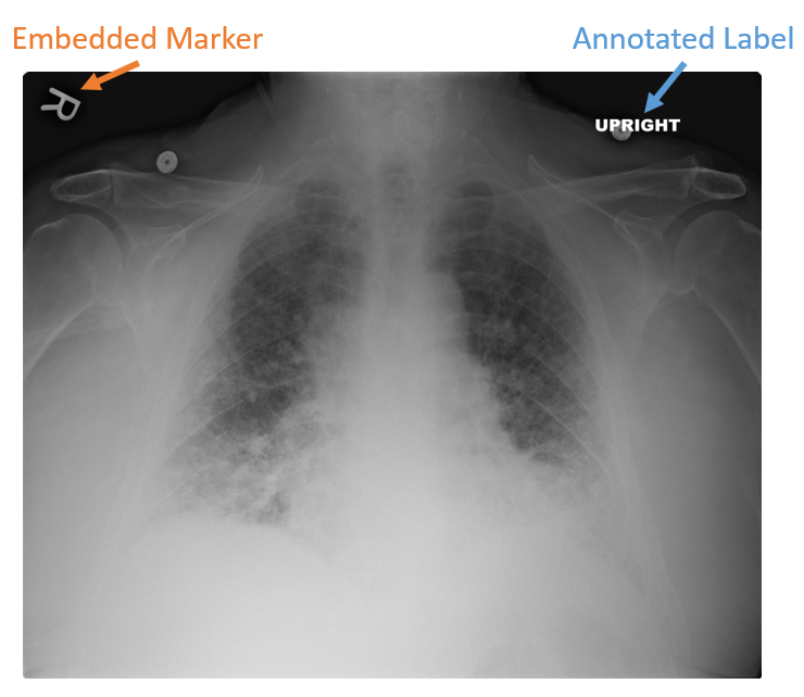 Guidelines for Image Evaluation – Digital Radiographic Exposure ...