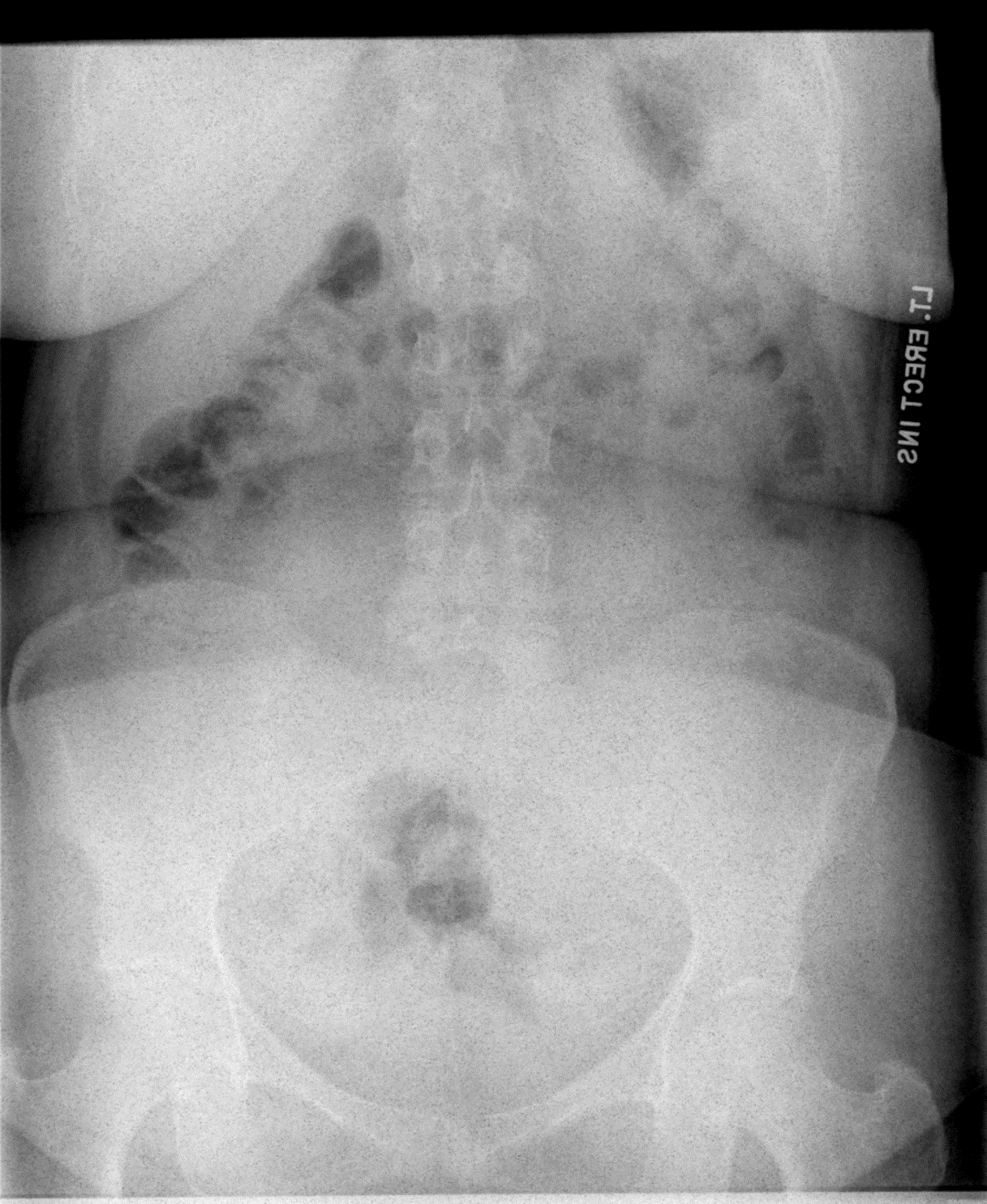 Guidelines for Image Evaluation Digital Radiographic Exposure